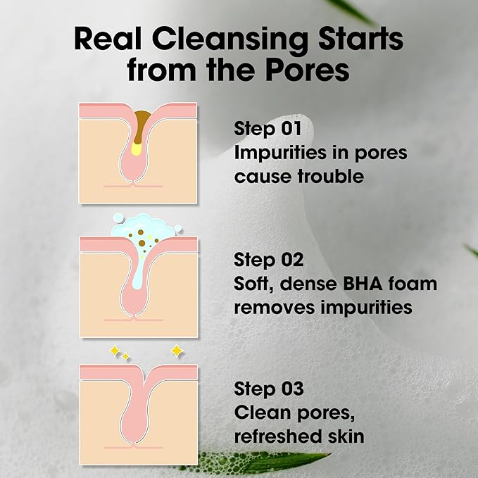 SOME BY MI AHA BHA PHA 30 Days Miracle Acne Clear Foam – Pack of 2 – Korean Acne Face Wash for Smooth & Clear Skin – Salicylic Acid Cleanser for Exfoliation & Sebum Control – Korean Skin Care