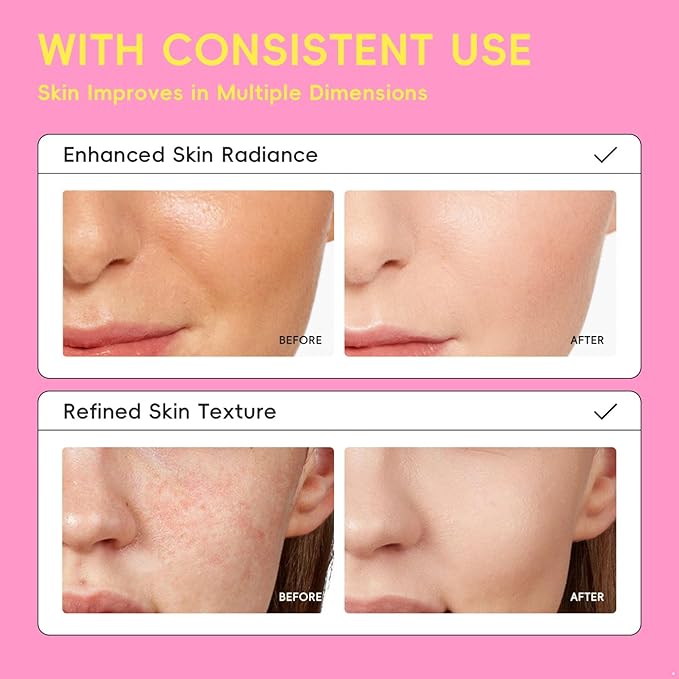 Facial Toner Mist 100ml, Hydrating Essence Water for Face, Gentle Daily Balancing Treatment for Even Texture Pink One Size