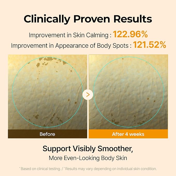 Dr.Melaxin Kojic Acid Turmeric Capsule Body Cream, Brightening Body Moisturizer for Dark Spots and Uneven Skin Tone, with Ceramides & Hyaluronic Acid, 200g