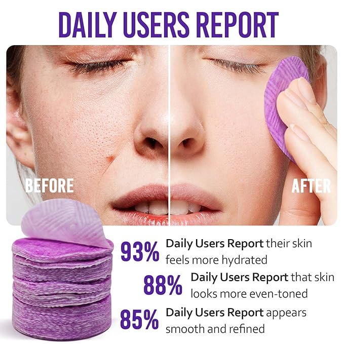 Onion Cleaning Toner Pads - 60 Pads Onion Face Exfoliating Pad & Face Exfoliator for Soothes and Reduces Acne and Pores, Smoother Texture, Alcohol-free, Fragrance-free and Colorant-free