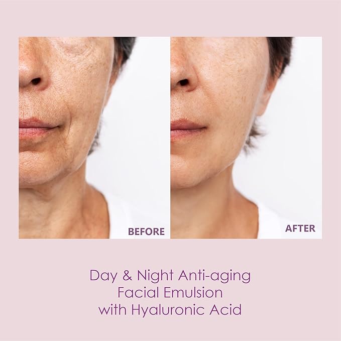 Hydrating Facial Emulsion with Hialuronika for Radiant Skin. Nourishes, Hydrates, Rejuvenates and leave your Skin with a Radiant Glow - Anti-aging - 1.69 fl oz