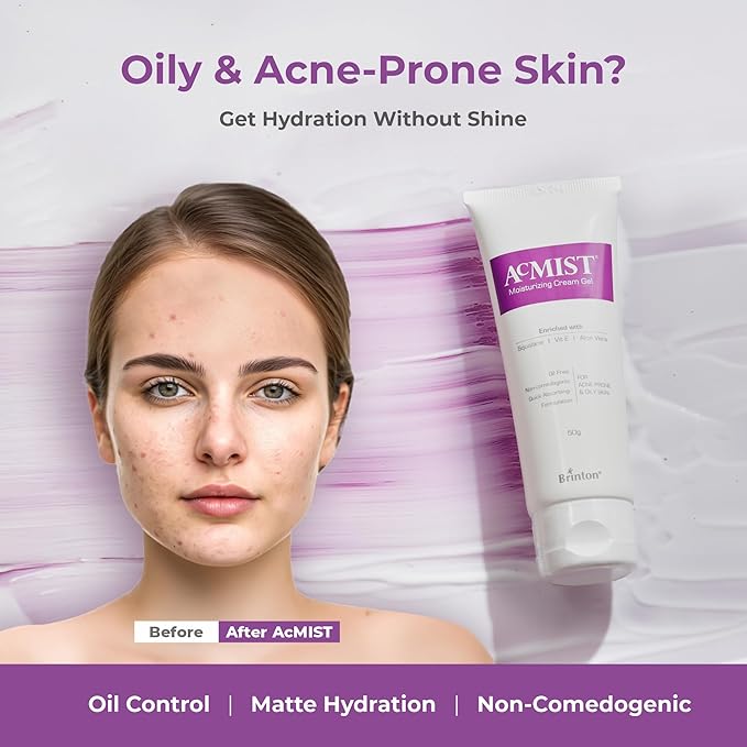 Acmist Moisturizing Cream Gel for Oily & Acne-Prone Skin | Oil-Free, Non-Comedogenic, Quick Absorbing & Makeup Friendly | With Vitamin E, Aloe Vera & Squalane | For Men, Women & Teens | 50g/1.67 oz.
