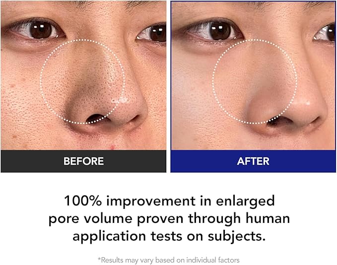 35% Smaller Pores & 32% Reduced Pore Area | Brightening Exfoliating Pads | Soothes, Hydrates & Brightens with CICA Exosomes, AHA/BHA/PHA & Fruit Enzymes | Korean Skincare | 70 Pads