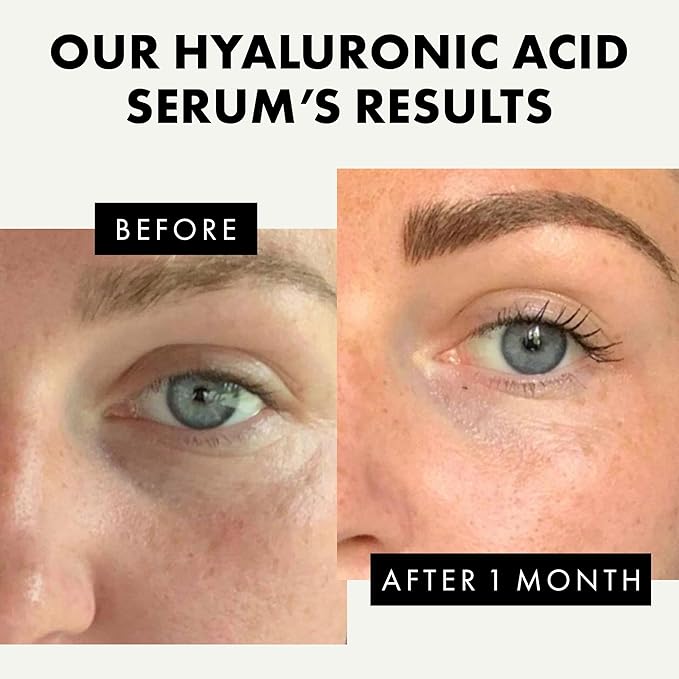 Eclat Skincare Unclog & Hydrate - Rose Water Toner and Hyaluronic Acid Serum - Combo Pack - 100% Vegan & Dermatologist Developed