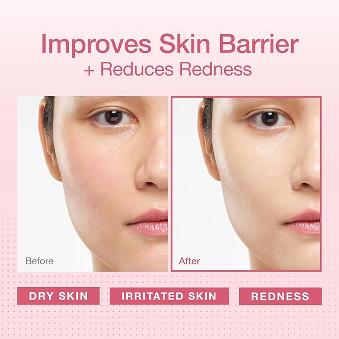 Physiogel Redness Reducing Cream – Ceramide Moisturizer for Dry, Sensitive & Redness-Prone Skin, Repairs Skin Barrier, Dermatologist-Tested, Fragrance-Free, Korean Skincare, 3.4 fl oz