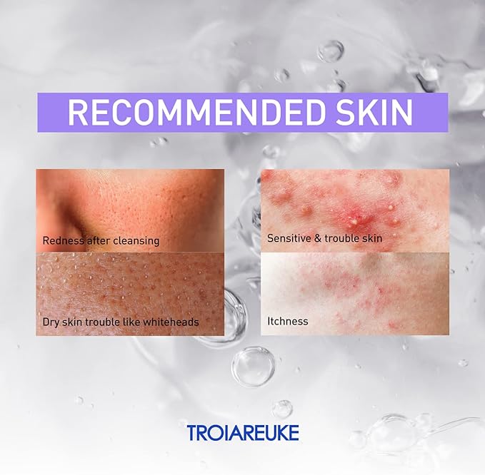 TROIAREUKE ACSEN CICA SEN Toner - Hypoallergenic, Relieve & Ultra-Soothing Effect for Sensitive, Trouble Skin, High CICA Concentrated Formula