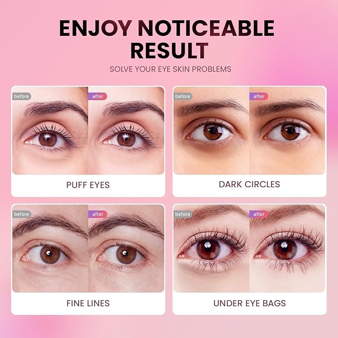Under Eye Patches (48 Pairs) - Tri-color Glitter Eye Gel Pads for Dark Circles, Puffy Eyes, Under eye Bags, Wrinkles | Natural Collagen Under Eye Mask Patches, Easter Basket Stuffers