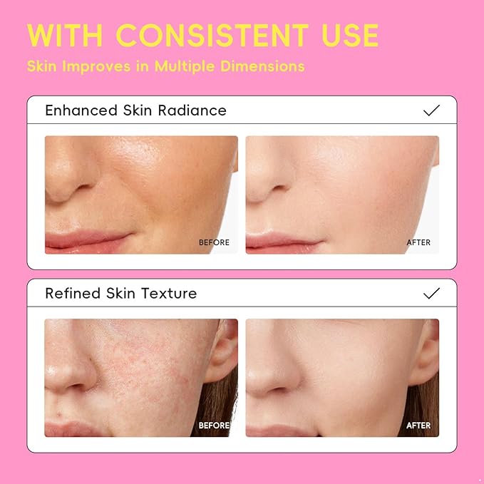 renvena Facial Essence Toner 100ml, Hydrating Spray for Balanced Skin, Daily Soothing Mist for Oily T-Zone Refine Pink One Size