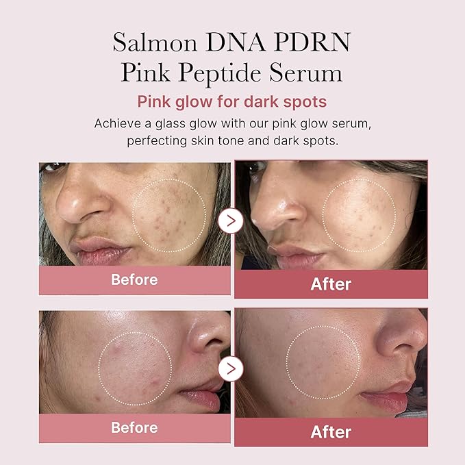 medicube Viral Serum Duo for Clear and Plump Skin: Kojic Acid Turmeric and Salmon DNA Pink Serum for Uneven Skin Tone & Texture Care | Korean Skincare, Giftable Skincare Set, Stocking Stuffers