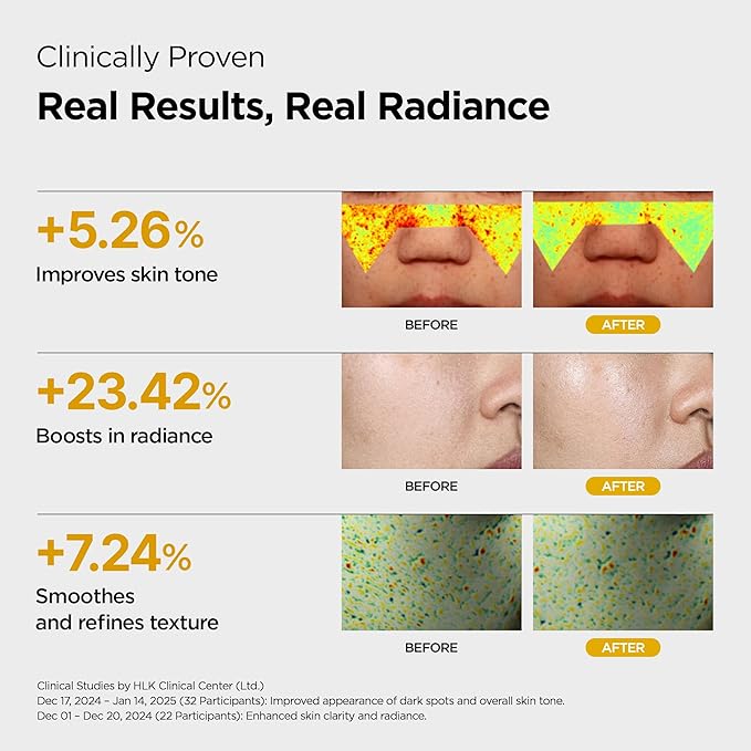 L-Glutathione Vitamin Boosting Toner infused with Niacinamide, Vitamin C, Glutathione & Tocopherol | Uneven & Dull Skin, Anti-Pigmentation Korean Skincare(5.07 fl oz / 150 ml)