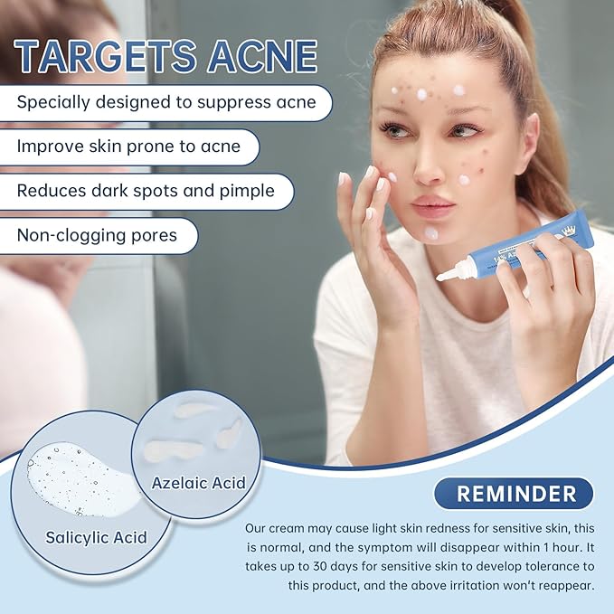 Azelaic Acid 14% Acne Cream for Redness Relief, Dark Spots, Facial Serum with Niacinamide & Vitamin C Prevent Acne Breakouts, Azelaic Acid Serum for Balance Excess Sebum & Soothe Irritation, 1 Oz.