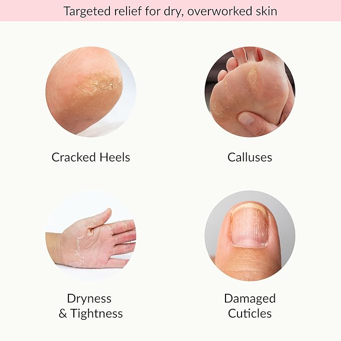 Epielle Moisturizing Hand & Foot Masks, Soften Dry Skin with Sunflower Seed Oil & Vitamin E, Self Care Gifts for Women, Spa Kit, Easter Basket Stuffers, 6 Moisturizing Gloves & 6 Moisturizing Socks