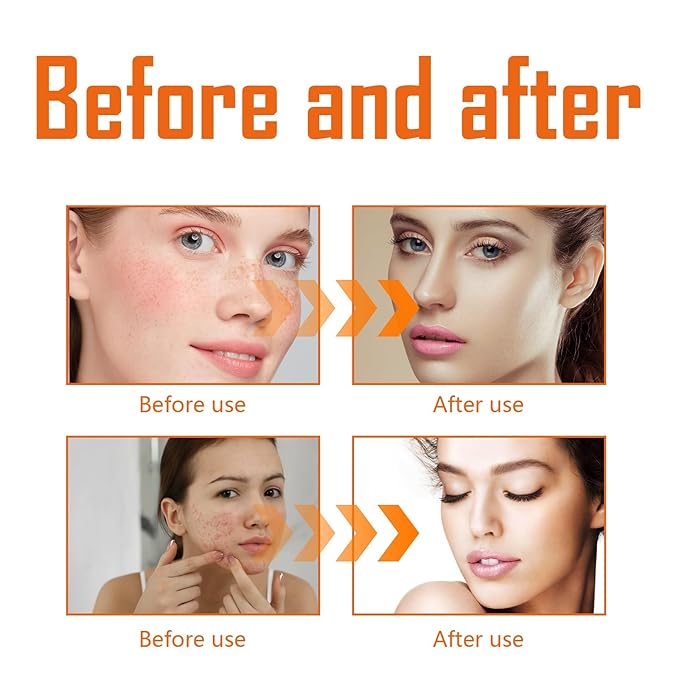 Turmeric Toner For Face - Deep Hydration, Brightening & Firming, Moisturizing To Smooth Skin, Even Tone, Reduce Redness(3PCS)