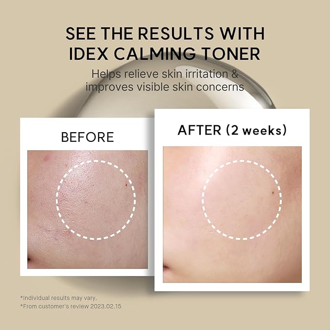 IDEX Calming Toner – Ultra-Light Watery Toner for Sensitive Skin, Daily Hydration & Soothing Relief with Ixeridium Dentatum Extract, Fragrance-Free (150ml / 5.07 fl.oz)