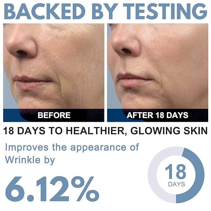 Ribose Cream, Ribose Sugar for Skin, Reduces Wrinkles, Moisturizer, Tightens & Firms the Skin, with D-Ribose Fractionated Coconut Oil and Grapeseed Oil, for All Skin Types, 2.5 oz