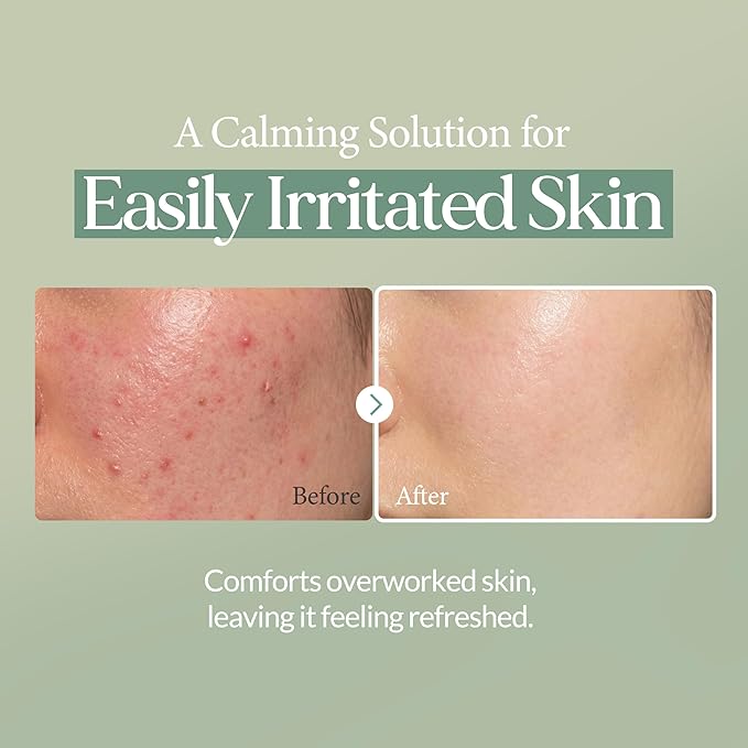 LU'PIUM Calming Repair Ampoule Pad – Vegan Soothing & Hydrating Toner Pads for Sensitive Skin, 300,800ppm Chamaecyparis Water & Cica Complex, Inspired by Korean Skincare