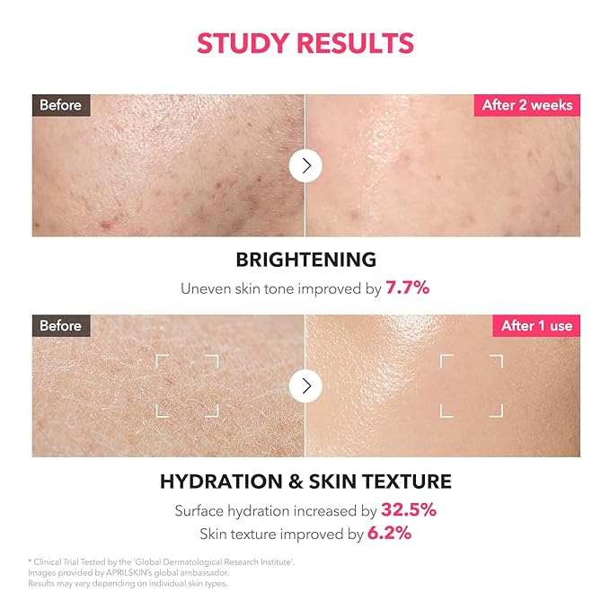 APRILSKIN TXA Glass Skincare Trio: TXA Niacinamide Toning Shot 99 Spicule Facial Serum, TXA Niacinamide 99 Pink Milky Toner and TXA Pink Capsule Gel Mask(4ea)
