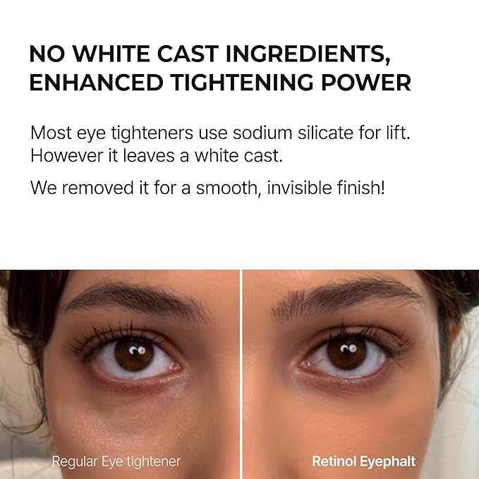 Dr.Melaxin Retinol Eyebag Cream for Puffiness, Dark Circles & Fine Lines, Wrinkle, EGF Anti-Aging Under Eye Moisturizer with Niacinamide&Ceramide Makeup friendly korean skin care