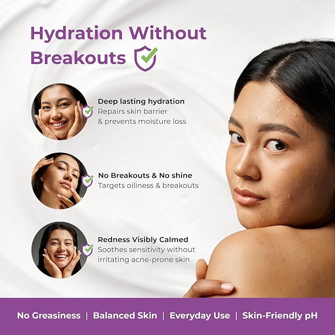 Acmist Moisturizing Cream Gel for Oily & Acne-Prone Skin | Oil-Free, Non-Comedogenic, Quick Absorbing & Makeup Friendly | With Vitamin E, Aloe Vera & Squalane | For Men, Women & Teens | 50g/1.67 oz.