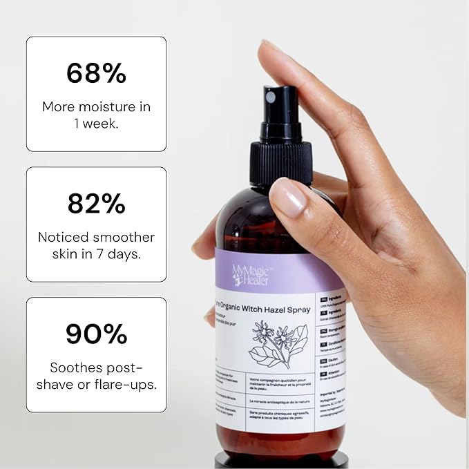 MyMagicHealer Organic Witch Hazel Spray | Calming Flare Care | Gentle Relief for Inflamed, Irritated, Swollen Skin | Ideal for Cystic Acne, Boils, Hidradenitis, Cysts, Ingrowns, and Fissures (8 oz)