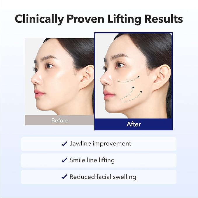 AVAJAR Chin Lifting Mask, Premium V Line Lifting Mask Anti-aging Collagen Face Mask for Women Jawline Shaper Double Chin Mask with Hyaluronic Acid, Rejubebe™ and Centella asiatica (5PCS)