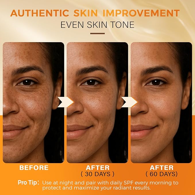 QOOQ Turmeric Kojic Acid Soap for Dark Spots Remover – Facial Cleansing Bar with Vitamin C, Retinol, Collagen, Vitamin E, Glycerin, Shea Butter & Castile Olive Oil – Soap for Women & Men (120g x 4)