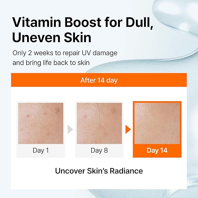 DearKlairs Vitamin C Serum, Gentle 5% Pure Vitamin C & EGF Peptides, for Uneven Skin Tone, Brightening, Dark Spot Care, Sensitive Skin, Non irritating, Korean Skincare 1.18 Fl Oz