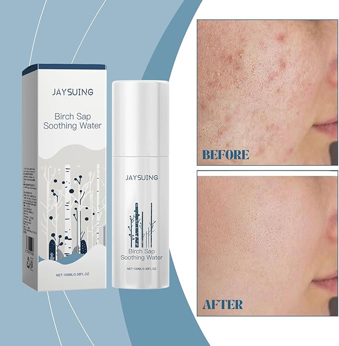 Calming Centella & Birch Sap Facial Toner for Sensitive Skin, Soothing Hydrating Face Mist to Repair Skin Barrier & Reduce Redness, 3.38 Fl Oz
