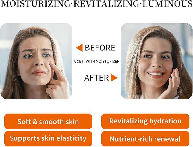 Rose Water Face Toner, Moisturizing & Anti-Aging for All Skin Types (10.1Fl oz)