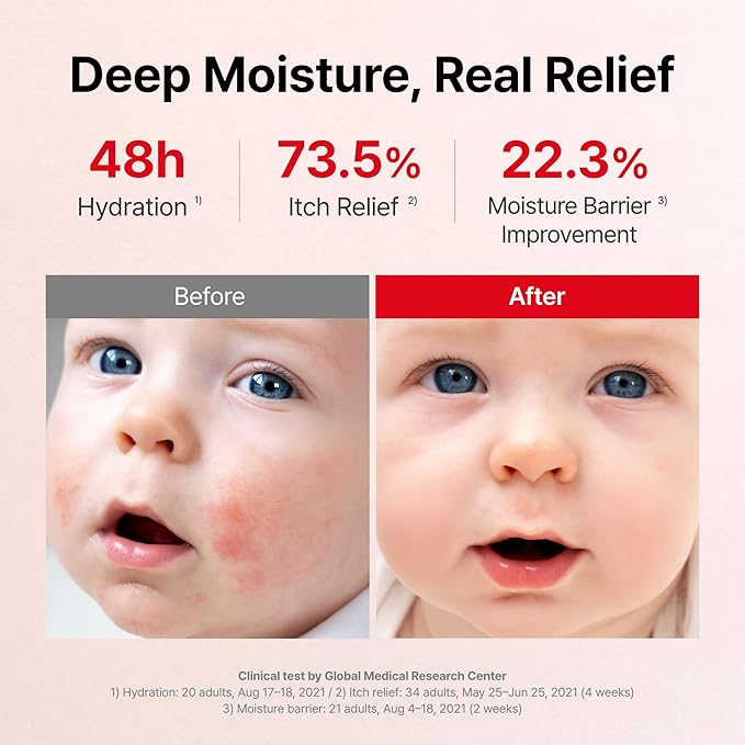 ATOPALM | MLE Eczema Cream | Premium Baby Face Cream | Body Moisturizer for Skin Barrier | Baby Lotion for Relieving Itchiness & Redness | Eczema Cream for Sensitive Skin | 5.6 fl oz (160ml)