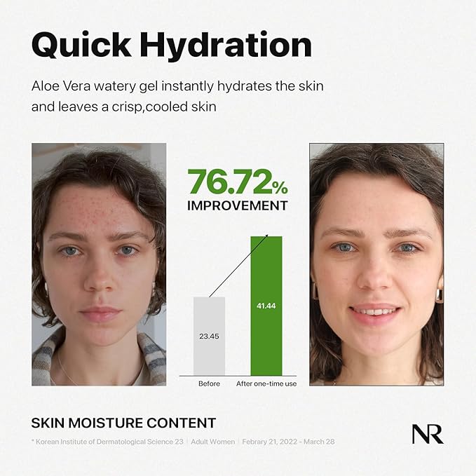 Nature Republic Mild & Moisture Aloe Vera Watery Gel (TUBE) | Quick Hydration & Moisturizing, Fast-Absorbing Non-Sticky Texture, Aftersun Cooling Gel, Korean Skincare, All Skin Types