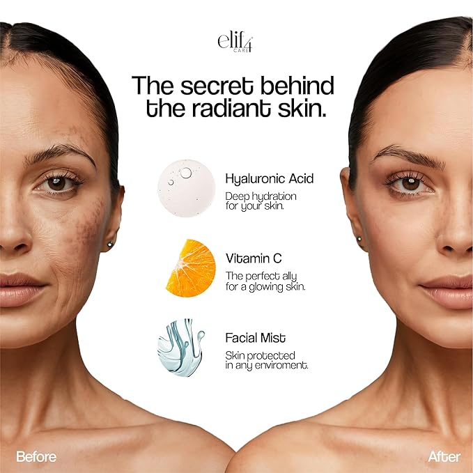 Elif 4 Care- Bruma Glow Hydrating Facial Mist – Daily Skin Refresher & Makeup Setting Spray – Aloe Vera, Calendula & Hyaluronic Acid – All Skin Types – 3.8 OZ