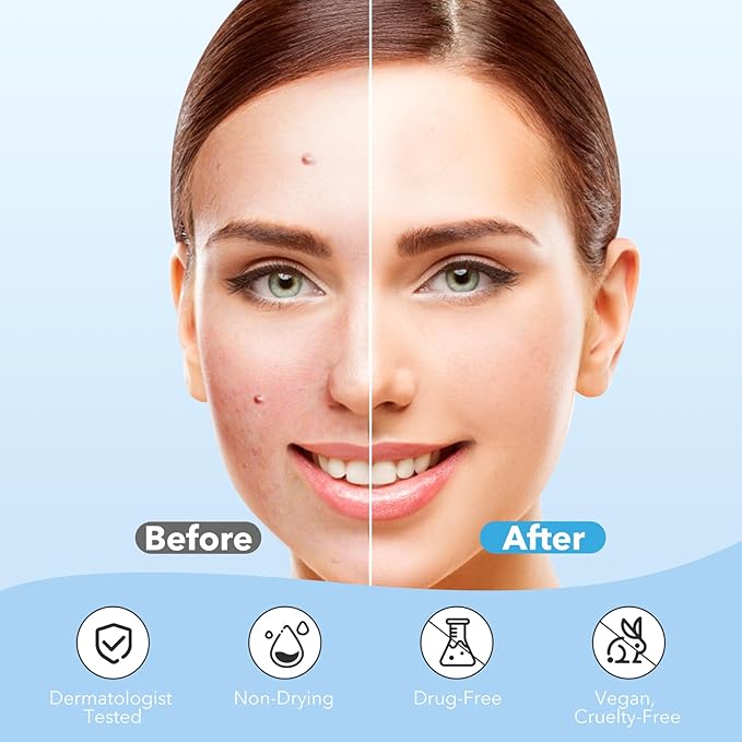 Pimple Patches for Face, Hydrocolloid Acne Patches, Cute Round Shape Zit Covers, Spot Stickers with Tea Tree, Salicylic Acid & Cica Oil| 2 Sizes (9mm, 12mm) |288 Count | Cute Round Shape, Zit Covers, Spot Stickers, with Tea Tree, Salicylic Acid, Cica Oil