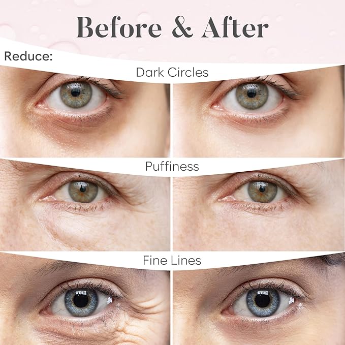 Rose Under Eye Patches (30 Pairs) - Under Eye Mask for Appearance of Dark Circles - For Puffy Eyes Smoothing - Skincare Mask