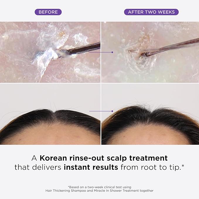 Dr. Groot Scalp Revitalizing Solution Scalp Happiness Set – LIMITED EDITION HOLIDAY SET