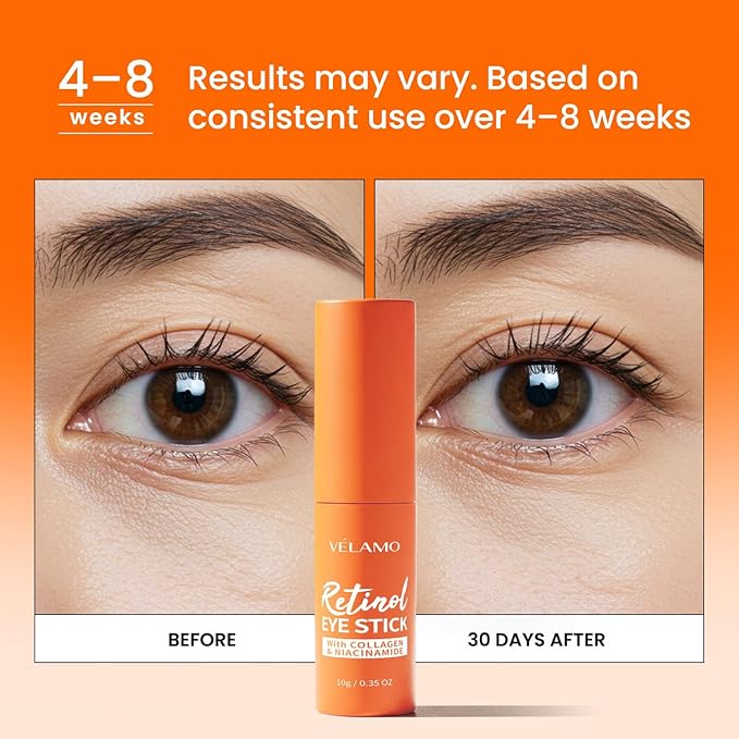 Retinol Under Eye Balm Stick: Korean Retinol Eye Cream for Dark Circles, Puffiness, Eye Bags, Wrinkles & Fine Lines - 8-IN-1 Formula with Collagen, Niacinamide, Peptides & Hyaluronic Acid 0.35 OZ 3Pcs