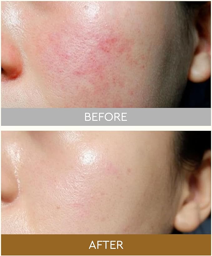 Rice Skin Toner Deep Hydrating Soothing Toner, Create Glass Skin Contains Niacinamide, Ceramides, Rice Bran Extract, Panthenol, Fragrance-Free, Cruelty-Free, Vegan, Suitable for All Skin Types