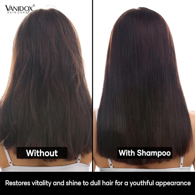 ReFortix Korean Shampoo, Enriched with Ginseng, Green Tea, and Camellia Oil, Supports Growth Stage and Helps Reduce Hair Loss for Stronger Hair (16 fl oz)