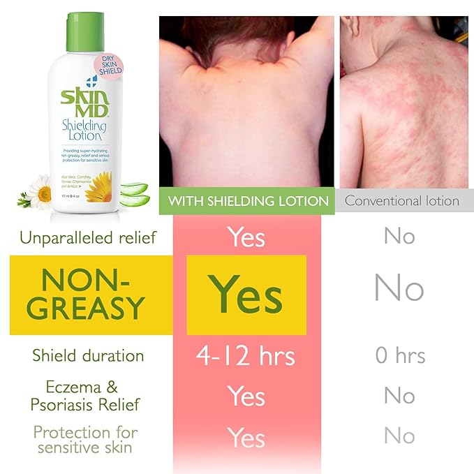 Skin MD Shielding Lotion - 4oz Hydrating Body Lotion for Sensitive Skin | Non-Greasy, Fast-Absorbing Moisturizer with Plant-Based Ingredients | Best Lotion for Dry Skin, Eczema & Psoriasis Relief