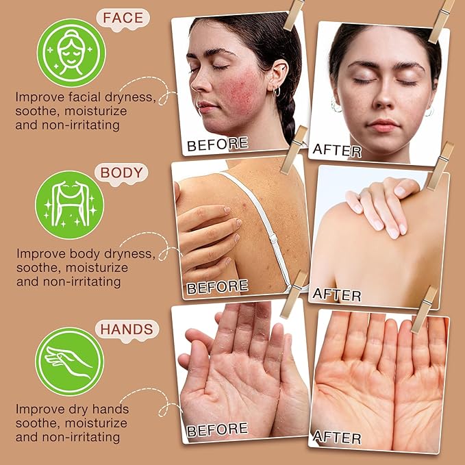 Beef Tallow for Skin,Beef Tallow for Face,Beef Tallow and Honey Balm,Grass Fed Whipped Tallow Honey Balm,Natural Moisturizer Hydrates,Deeply Nourishes the Skin, Enhances Natural Radiance