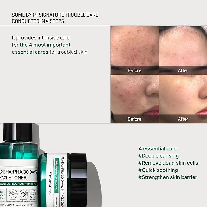 SOME BY MI AHA BHA PHA 30Days Starter Kit - Toner 1.01Oz, Serum 0.33Oz, Cream 0.7Oz, Cleansing Bar 1.05Oz - Mild Exfoliating Daily Skin Care Set - Skin Wastes, Sebum, Oiliness Care - Korean Skin Care
