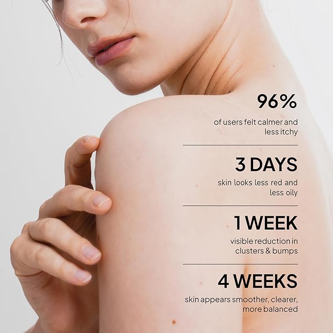 Fungal Acne Care 2-Step Routine: Helps with Bumps, Clusters, Itch & Redness – Body Acne Scrub + Lightweight Anti-Fungal Face & Body Lotion for Fungal Skin with Natural Actives