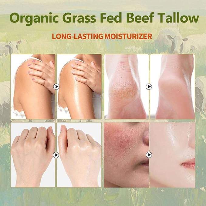 Grass Fed Beef Tallow with Frankincense Oil and Castor Oil, Organic Grass Fed Beef Tallow for Skin, Whipped Beef Tallow Frankincense Oil Castor Oil for Skin Face Body Moisturizer (1)