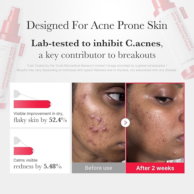 medicube Swipe & Spray Red duo for Troubled Skin: Red Succinic Acid Panthenol Facial Peeling Pads and Power Soothing Spray