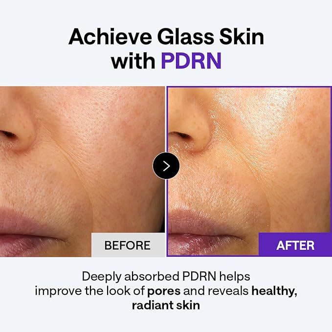 Mediheal PDRN Glass Skin Lifting Bundle – Stretchable Toner Pads (100ct) + PDRN Lifting Serum + Derma Cream | Pore Care, Firming & Deep Hydration