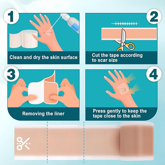 Arme Silicone Scar Tape, Silicone Scar Sheets for Surgical Scars(1.6"x180" Roll-4.6M), Medical Grade Scar Tape Reusable Sheets for Scar Treatment, Soft Scars Tapes for C-Section Keloid Tummy Tuck