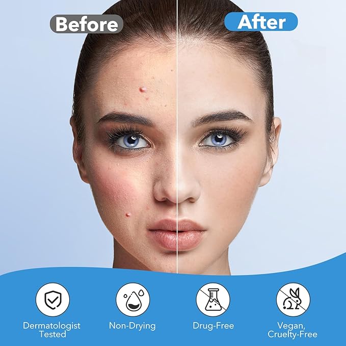 Pimple Patches for Face, Acne Patches Hydrocolloid, Cute Star Zit Covers for Face, Spot Stickers with Tea Tree, Salicylic Acid & Cica Oil| Round,Star,Peach Shapes| 5 Sizes| 282 Count
