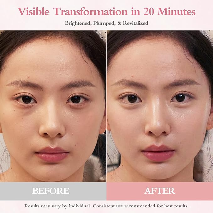 PDRN Under Eye Patches for Puffy Eyes and Dark Circles, 5000ppm Salmon DNA & Retinal Eye Mask for Face, Anti Aging Hydrogel Eye Gels for Smile Line, Wrinkles & Bags, 60 Pcs