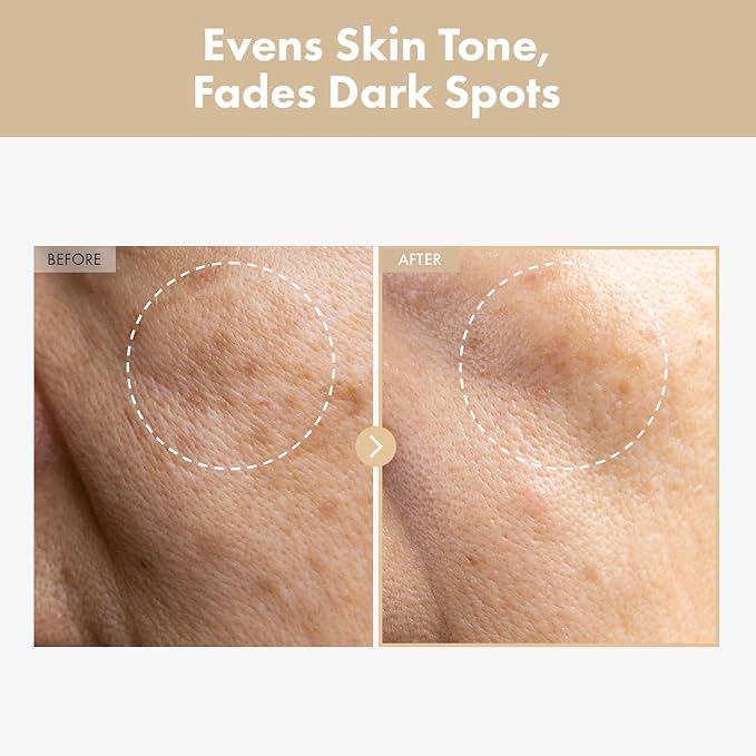 TOSOWOONG Radiance & Clarity Duo: Arbutin 7% Glutathione Cream & Rice Glow Milky Toner for Clearer, Luminous Skin