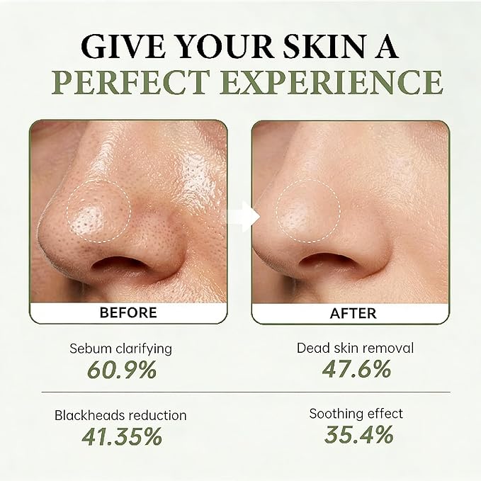 Rice Mochi Face Cleanser, All in One for Face Wash & Mask, Deep Cleansing Moisturizing, Blackhead Remover, Sebum Control, with Rice Water, Green Tea & Walnut Shell Powder, 4.23 OZ